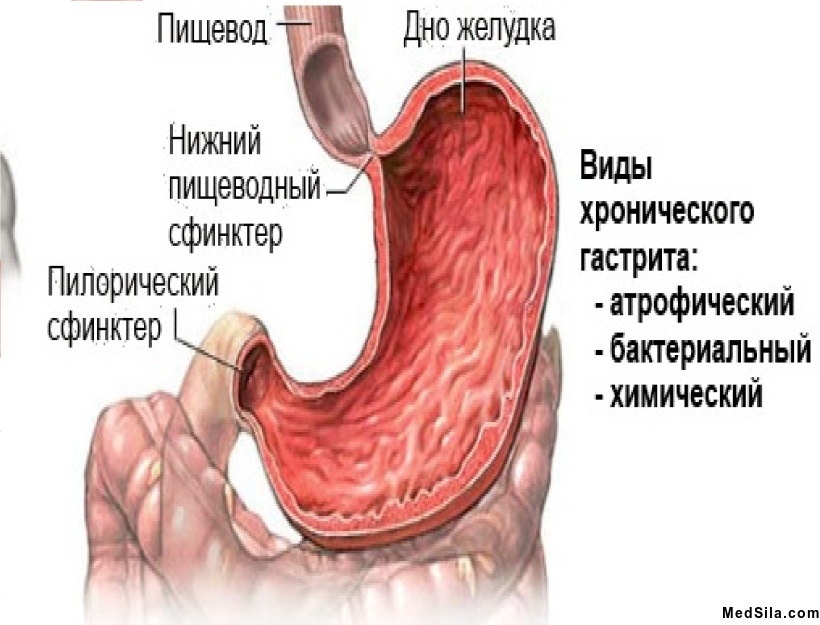 Отделы желудка